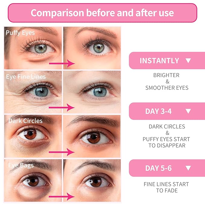 Breylee rose eye mask -