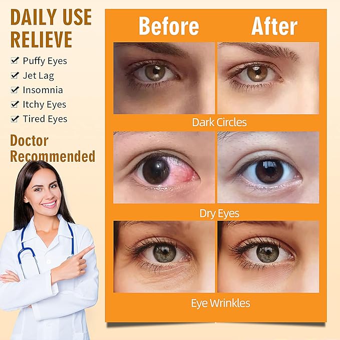 Serfeymi 16 packs steam eye