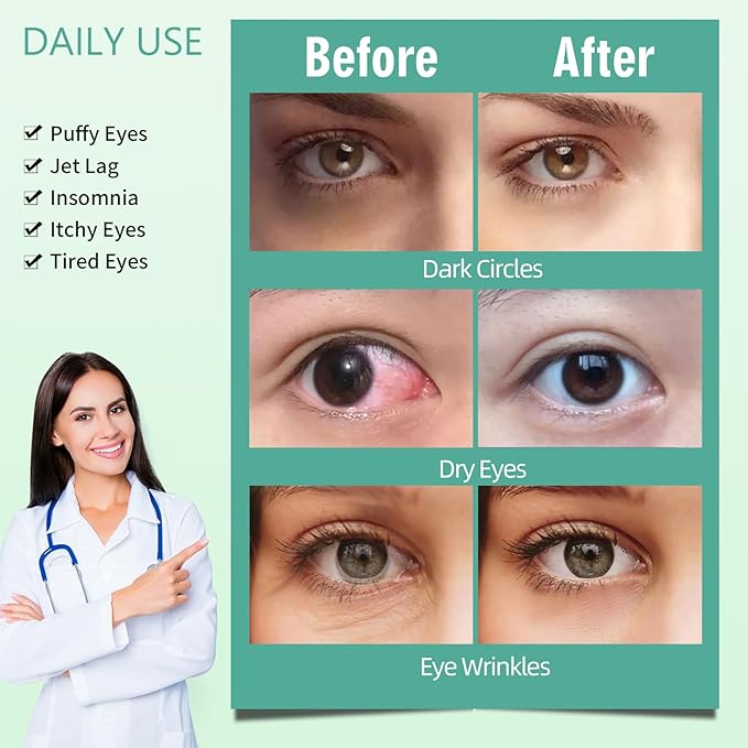 Serfeymi 10 packs steam eye