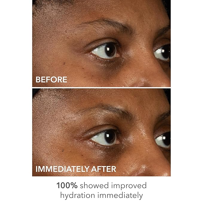 Dr dennis gross derminfusions lift