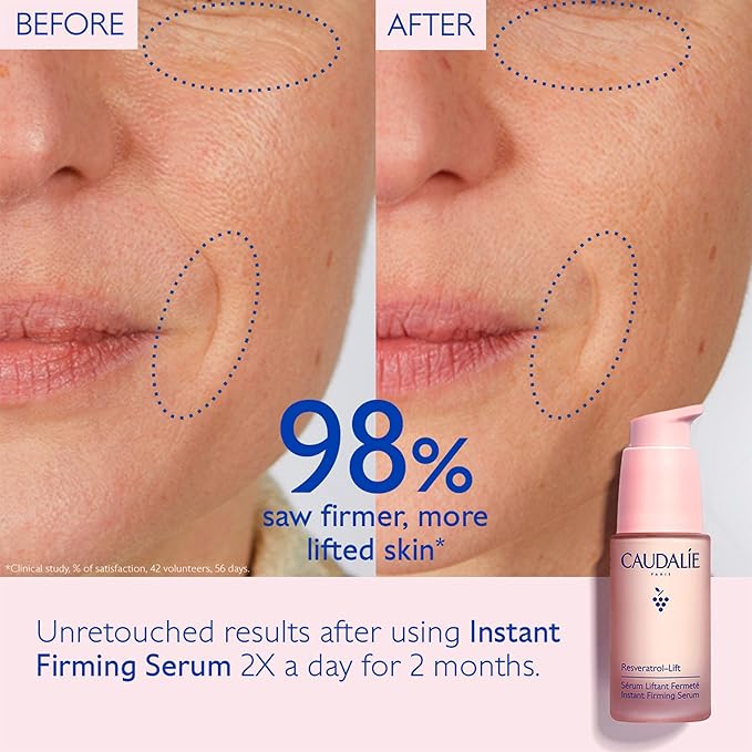 Caudalie Resveratrol-Lift Instant Firming Retinol Alternative Serum, Refillable - 30 mL